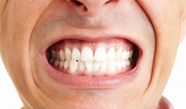 MİGRENLE KARIŞTIRMAYIN, DİŞLERİNİZİ GICIRDATIYOR OLABİLİRSİNİZ